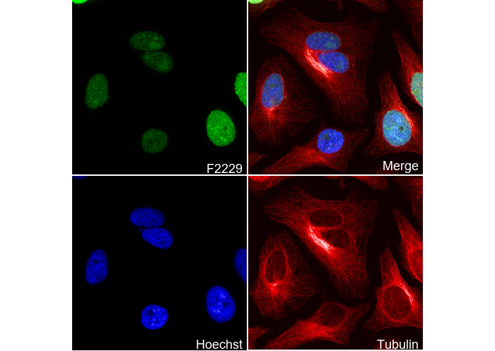 Phospho-Histone H3 (Ser10/Thr11) Antibody