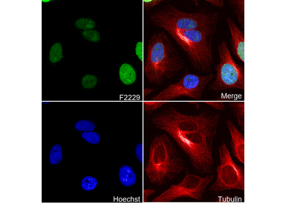 Phospho-Histone H3 (Ser10/Thr11) Antibody
