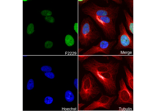 Phospho-Histone H3 (Ser10/Thr11) Antibody