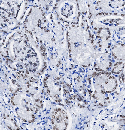 hnRNP C1 + C2/HNRNPC Antibody