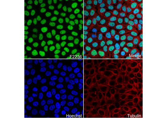 FTO Antibody