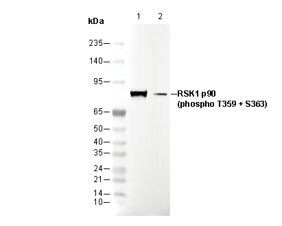 Phospho-RSK1 p90 (T359/S363) Antibody
