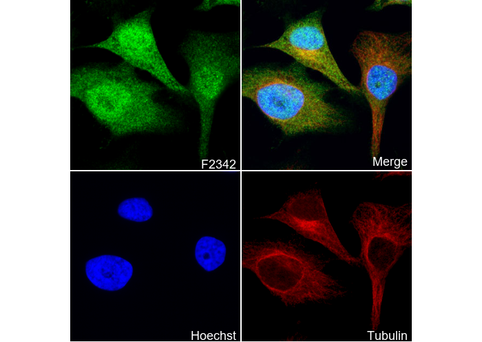 CDKN2A/p16INK4A + CDKN2B/p15INK4B Antibody