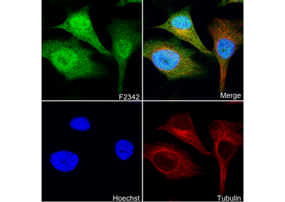 CDKN2A/p16INK4A + CDKN2B/p15INK4B Antibody