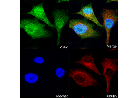 CDKN2A/p16INK4A + CDKN2B/p15INK4B Antibody