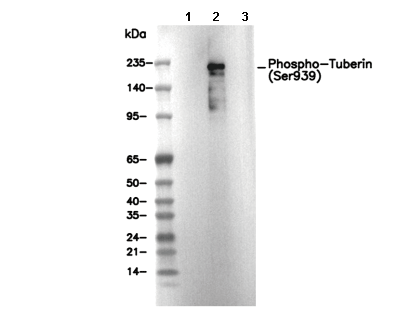 Phospho-Tuberin (Ser939) Antibody