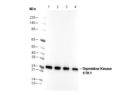 Thymidine Kinase 1/TK1 Antibody