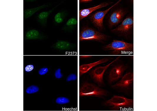 Cyclin E2 Antibody