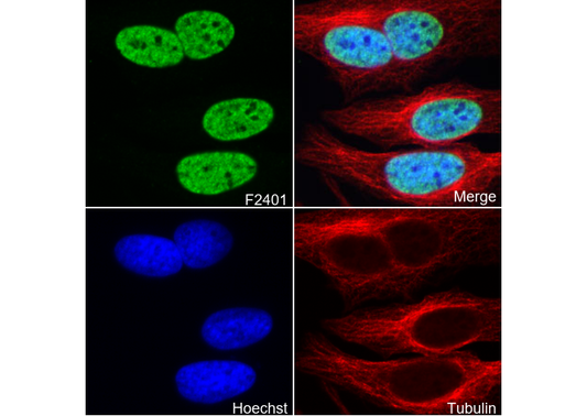 Histone H3 (acetyl Lys56) Antibody