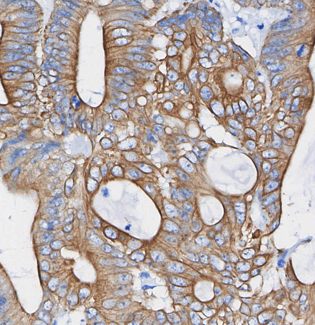 Keratin 12/K12 Antibody