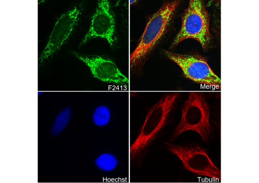 ACADM/MCAD Antibody