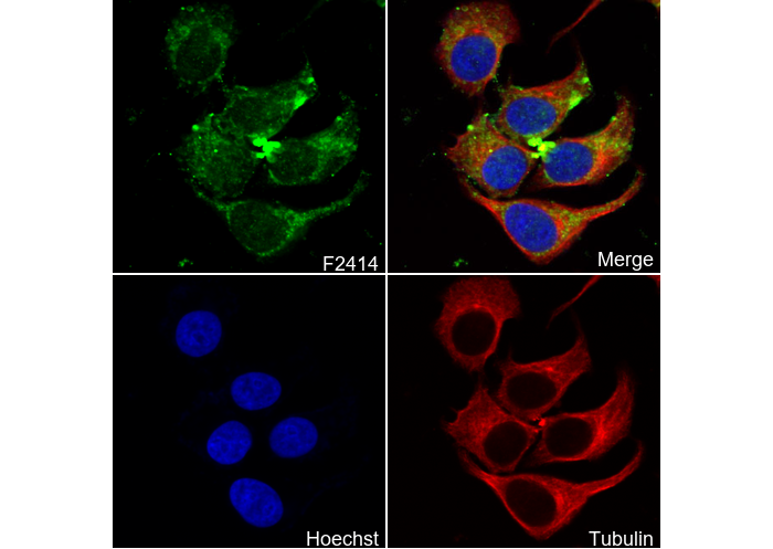 CPT2 C-terminal Antibody