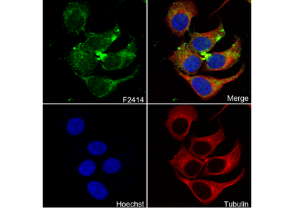 CPT2 C-terminal Antibody