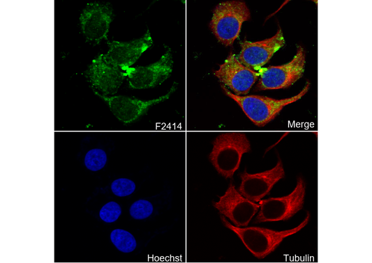 CPT2 C-terminal Antibody