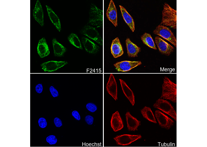 Adrenergic α 1A Receptor/ADRA1A Antibody