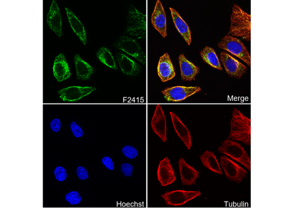 Adrenergic α 1A Receptor/ADRA1A Antibody