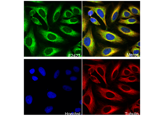 NDUFB4 Antibody