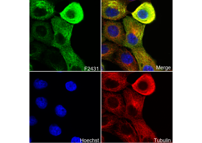Cytokeratin 16/K16 Antibody