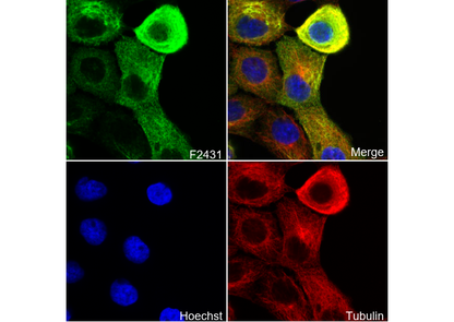 Cytokeratin 16/K16 Antibody
