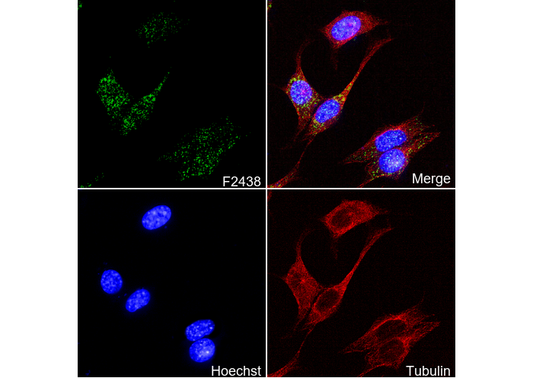 ACOX1/AOX Antibody