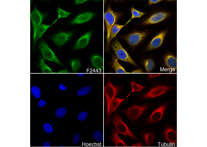 Calpain 1 Antibody
