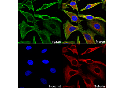 γ Actin Antibody