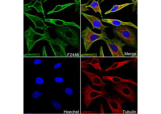 γ Actin Antibody