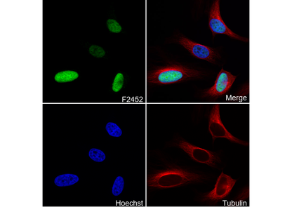 KIFC1 Antibody