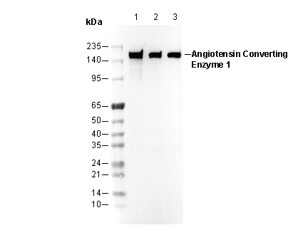 Angiotensin Converting Enzyme 1 Antibody