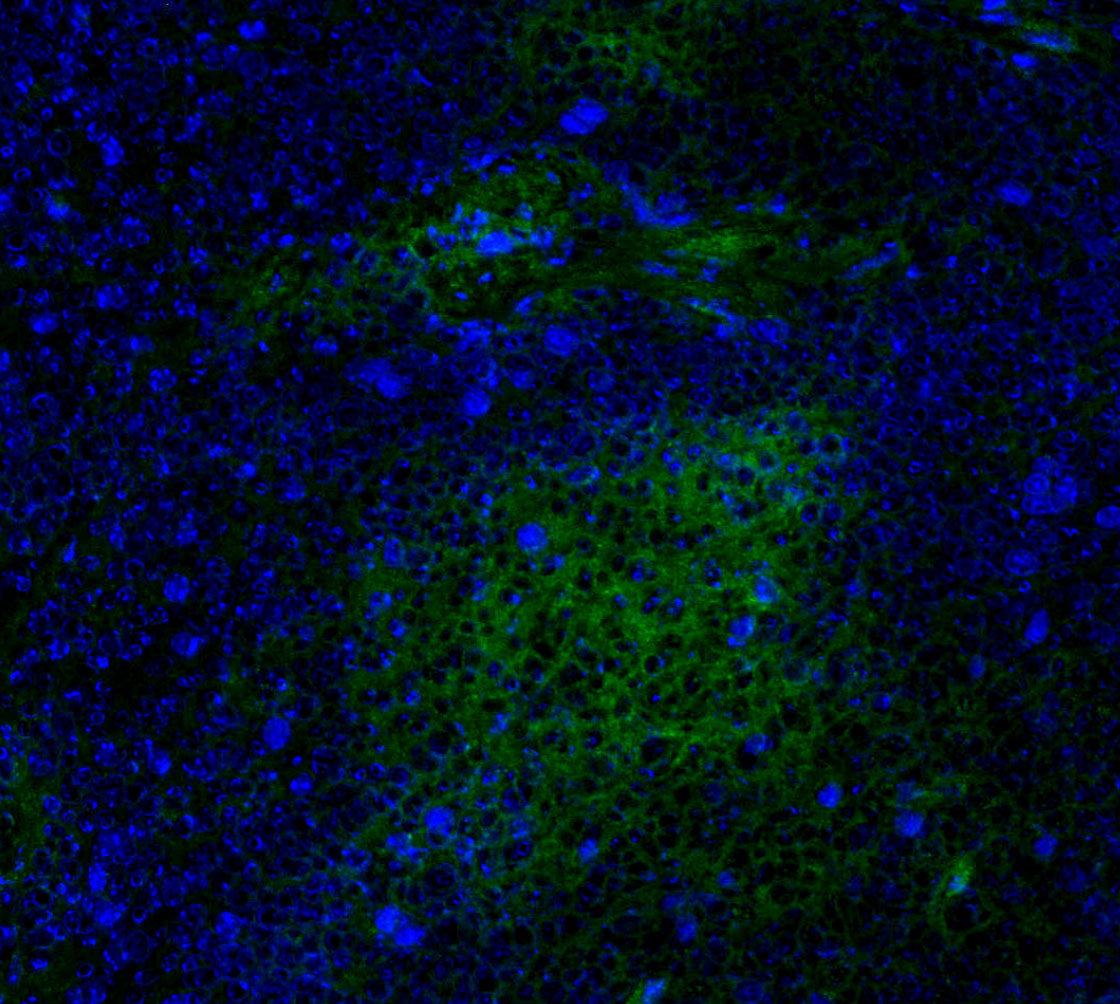 CD39 Antibody