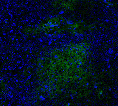 CD39 Antibody