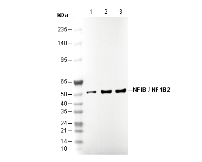 NFIB / NF1B2 Antibody