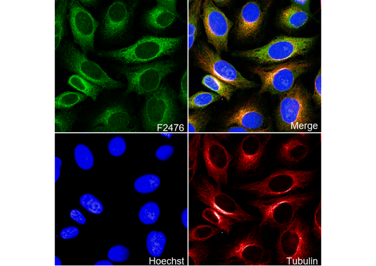 FBP1 Antibody