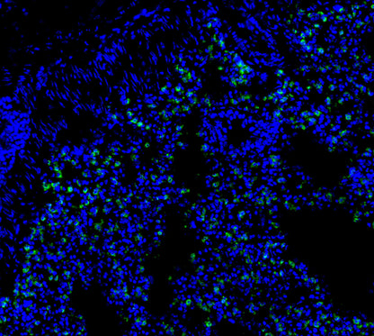 Prosurfactant Protein C Antibody