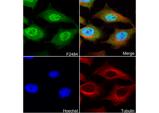 STAT5b Antibody