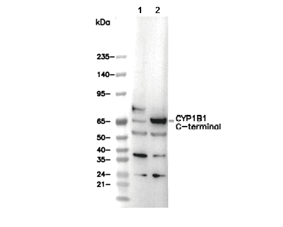 CYP1B1 C-terminal Antibody