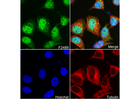 SMYD3 Antibody