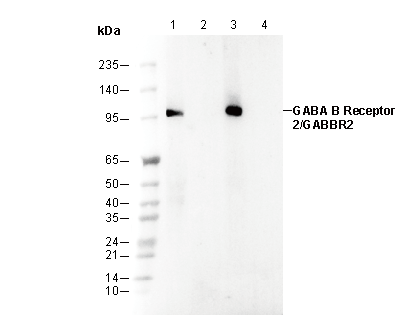 GABA B Receptor 2/GABBR2 Antibody