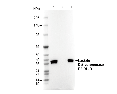 Lactate Dehydrogenase B/LDH-B Antibody