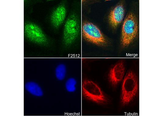 Phospho-STAT3 (Tyr705) (L7D9) Antibody