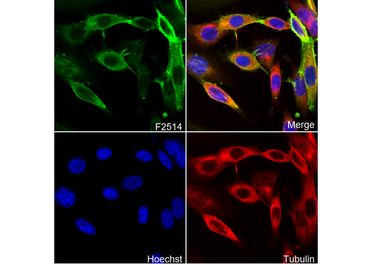 α smooth muscle Actin / α-SMA Antibody