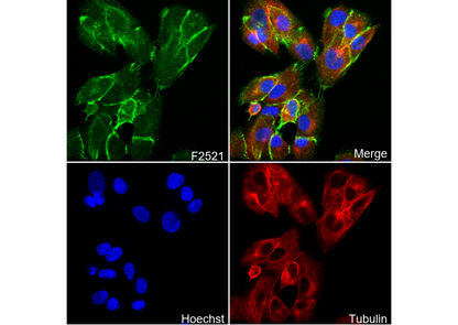 β-Catenin Antibody