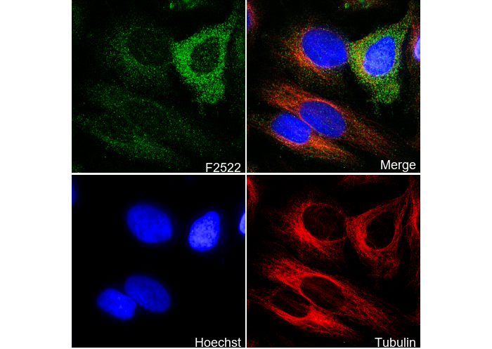 Cyclin B1 Antibody