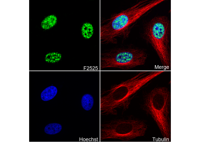 Phospho-CREB (Ser133) Antibody