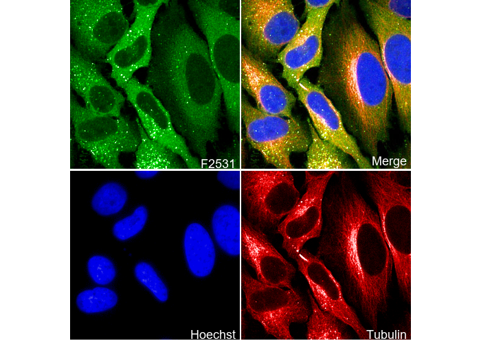 SQSTM1/p62 Antibody