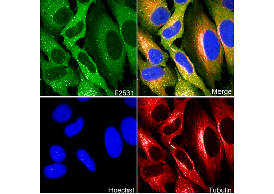 SQSTM1/p62 Antibody