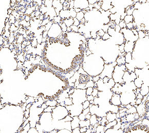 ATP-binding cassette sub-family A member 3 Antibody