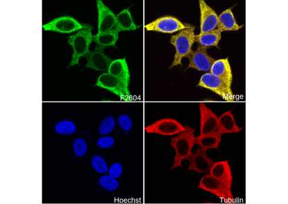 Anterior Gradient 2 Antibody