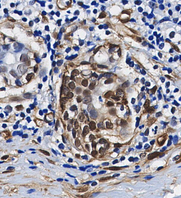 RARγ1 Antibody