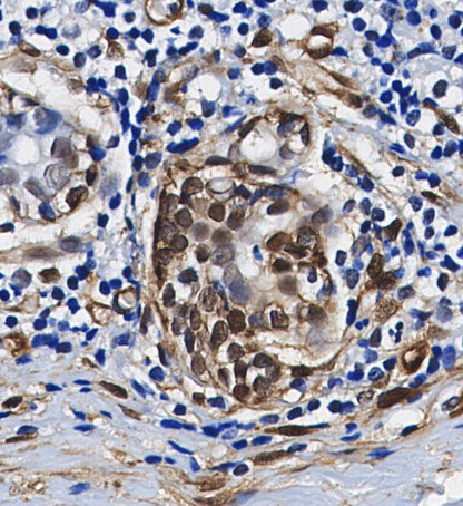 RARγ1 Antibody
